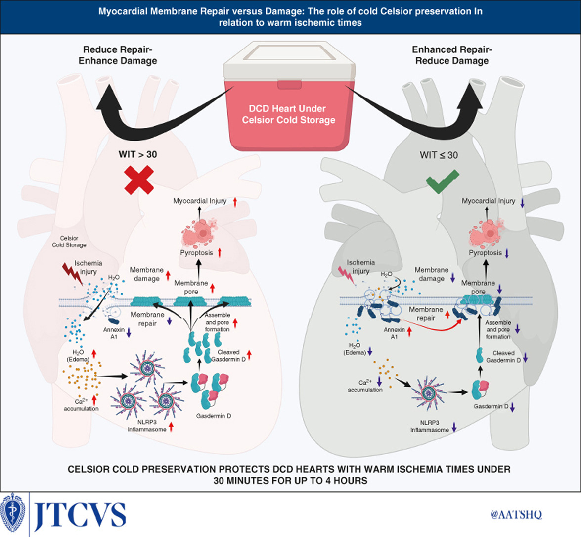 Long-Term Outcome of Myocardial Protection in Heart Transplantation ...